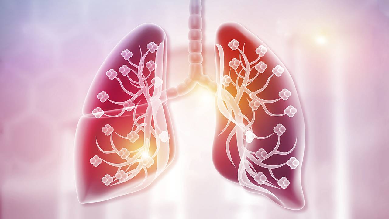 Bronquitis Aguda Signos Causas Complicaciones Y Tratamiento | My XXX ...